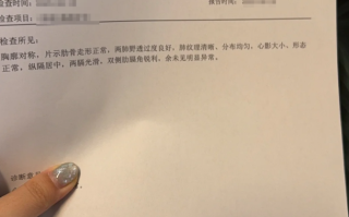 毕节找人代替抽血鸡西入职体检报告