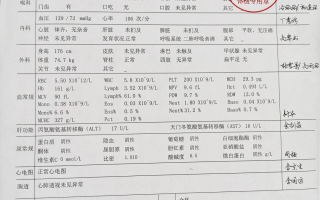 毕节找人代替抽血苏州工业园区入职体检